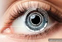 Does Turkey’s SGK Cover Smart Lenses? 2026 Update