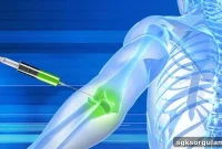 Does Turkish Social Security Cover Prolotherapy? 2026 Guide